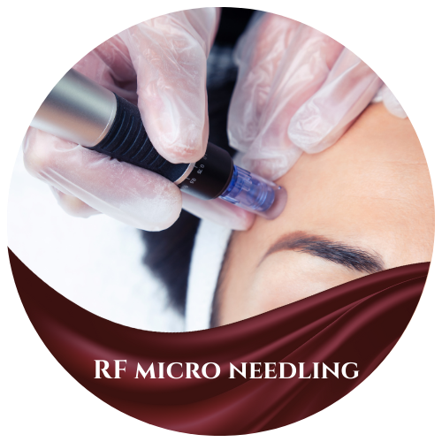 RF Microneedling